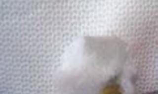 卫生巾有虫 卫生巾有虫